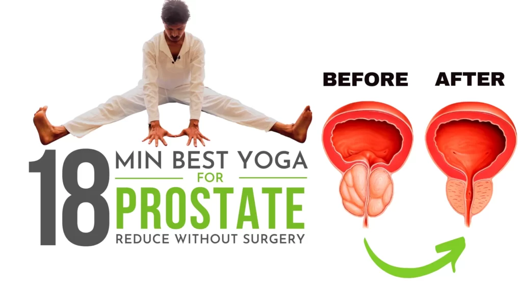 Reduce-Enlarged-Prostate-without-Surgery-Yoga-for-Prostate-Problems