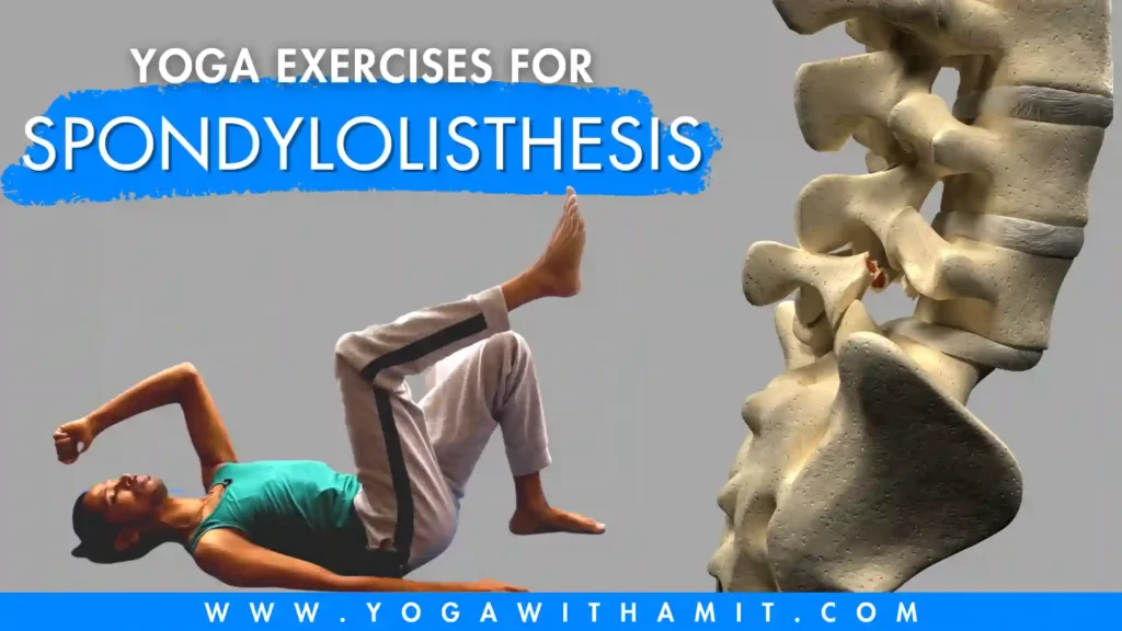 Best Yoga Exercises For Spondylolisthesis YOGA WITH AMIT