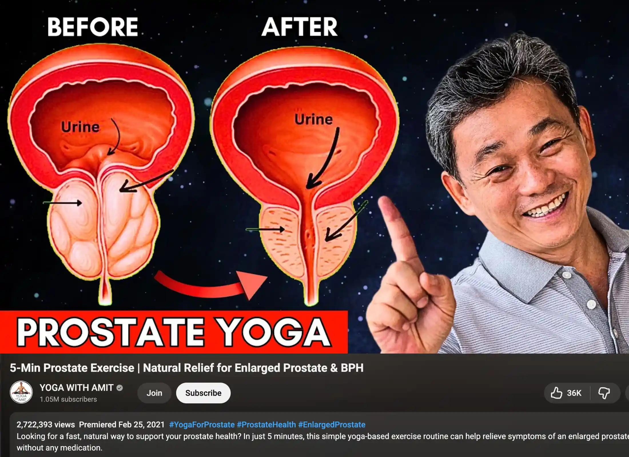 yoga-for-prostate-treatment