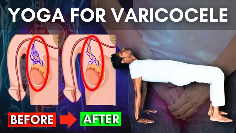 Yoga pose for varicocele relief Amit Namdev