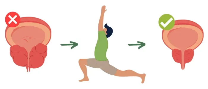 Exercises-for-men-with-prostate-problems-and-overactive-bladder